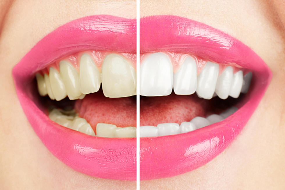 چگونه ماندگاری بلیچینگ دندان را افزایش دهیم؟