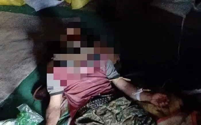 نوجوان ۱۶ ساله قربانی خشم خرس شد