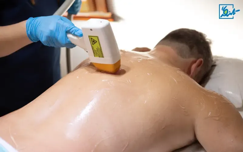 لیزر مو: انتخاب کسانی که به زیبایی اهمیت می‌دهند