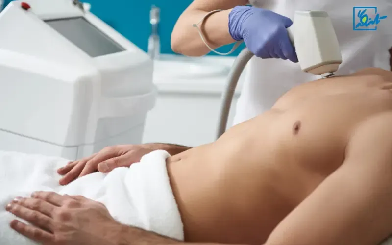 لیزر مو: انتخاب کسانی که به زیبایی اهمیت می‌دهند